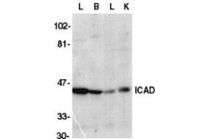 Western blot analysis of ICAD in mouse lung (L), brain (B), liver (L), and kidney tissue lysate with AP30399PU-N CAD antibody at 1/1000 dilution. (DFFA Antikörper  (C-Term))