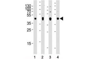 Western blot analysis of lysate from 1) human skeletal muscle, 2) human brain, 3) mouse brain, and 4) rat brain tissue using PDK2 antibody at 1:2000 for each lane. (PDK2 Antikörper)