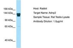 ADNP2 Antikörper  (N-Term)