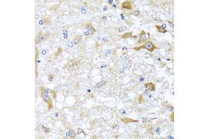 Immunohistochemistry of paraffin-embedded rat brain using ABCB8 antibody. (ABCB8 Antikörper)