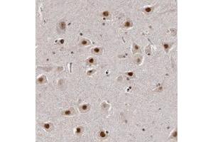 Immunohistochemical staining of human hippocampus with INTS6 polyclonal antibody  shows strong nuclear positivity in neuronal cells at 1:50-1:200 dilution.