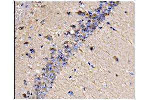 IHC analysis of Dynamin 3/DNM3 using anti-Dynamin 3/DNM3 antibody (ABIN7601163). (Dynamin 3 Antikörper  (AA 295-712))