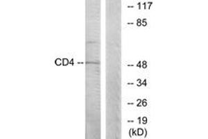 Western blot analysis of extracts from COLO205 cells, using CD4 (Ab-433) Antibody.
