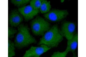 Immunofluorescence analysis of A549 cells using ARRB1 antibody (ABIN5996907). (beta Arrestin 1 Antikörper)