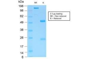 SDS-PAGE analysis of purified, BSA-free recombinant Gastric Mucin antibody (clone MUC6/1553R) as confirmation of integrity and purity. (MUC6 Antikörper)