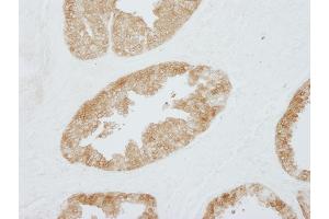 Immunohistochemistry (IHC) image for anti-Stratifin (SFN) (AA 198-248) antibody (ABIN7448925) (14-3-3 sigma/SFN Antikörper  (AA 198-248))