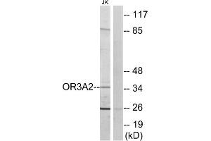 Western blot analysis of extracts from Jurkat cells, using OR3A2 antibody. (OR3A2 Antikörper  (C-Term))