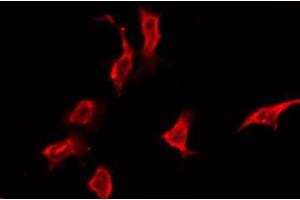 ABIN6276171 staining Hela by IF/ICC. (OR5K3 Antikörper  (Internal Region))