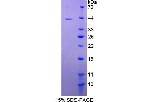 Image no. 1 for S100 Calcium Binding Protein A2 (S100A2) (AA 1-97) protein (His tag,GST tag) (ABIN4988972) (S100A2 Protein (AA 1-97) (His tag,GST tag))