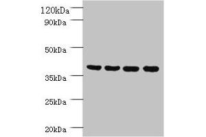 Western blot All lanes: Prootein FAM110B antibody at 2 μg/mL Lane 1: Mouse sexual gland tissue Lane 2: HepG2 whole cell lysate Lane 3: Mouse spleen tissue Lane 4: A431 whole cell lysate Secondary Goat polyclonal to rabbit IgG at 1/10000 dilution Predicted band size: 41 kDa Observed band size: 41 kDa (TMEM185B Antikörper  (AA 1-370))