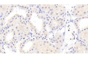 Detection of PCK2 in Human Kidney Tissue using Polyclonal Antibody to Phosphoenolpyruvate Carboxykinase 2, Mitochondrial (PCK2) (PEPCK Antikörper  (AA 33-198))