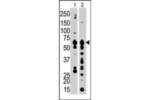 The PFKFB3 polyclonal antibody  is used in Western blot to detect PFKFB3 in Jurkat cell lysate (Lane 1) and mouse brain tissue lysate (Lane 2) . (PFKFB3 Antikörper  (C-Term))