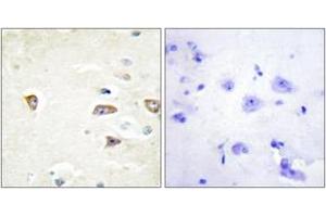 Immunohistochemistry analysis of paraffin-embedded human brain tissue, using MRCKB Antibody.