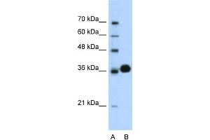 WB Suggested Anti-CDK6 Antibody Titration:  0. (CDK6 Antikörper  (C-Term))