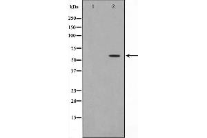 Western blot analysis on HeLa cell lysate using Dyskerin Antibody,The lane on the left is treated with the antigen-specific peptide. (DKC1 Antikörper  (Internal Region))