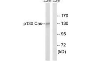 Western blot analysis of extracts from HuvEc cells, using p130 Cas (Ab-410) Antibody. (BCAR1 Antikörper  (AA 376-425))