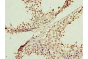 Immunohistochemistry of paraffin-embedded human testis tissue using ABIN7152484 at dilution of 1:100 (FBXL5 Antikörper  (AA 1-310))