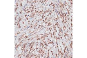 Immunohistochemistry of paraffin-embedded human uterus using RP/RP/RP antibody (ABIN6128653, ABIN6147083, ABIN6147084 and ABIN6214011) at dilution of 1:100 (40x lens). (RPA1 Antikörper  (AA 1-240))