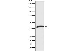Western blot analysis of ERK1 in Jurkat cell lysate.