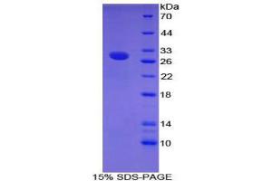 SDS-PAGE (SDS) image for Contactin Associated Protein-Like 4 (CNTNAP4) (AA 402-633) protein (His tag) (ABIN2124498)