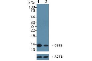 Knockout Varification: ;Lane 1: Wild-type HepG2 cell lysate; ;Lane 2: CSTB knockout HepG2 cell lysate; ;Predicted MW: 11kDa ;Observed MW: 14kDa;Primary Ab: 2µg/ml Rabbit Anti-Human CSTB Antibody;Second Ab: 0. (CSTB Antikörper  (AA 1-98))