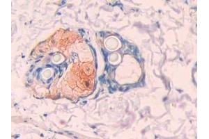 Immunohistochemistry (IHC) image for anti-Carbonic Anhydrase 12 (CA12) (AA 154-307) antibody (ABIN7437902)