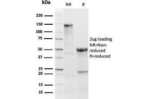 SDS-PAGE Analysis Purified TPO Recombinant Rabbit Monoclonal Antibody (TPO/3813R). (Rekombinanter TPO (AA 685-804) Antikörper)