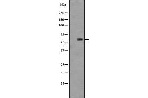 Western blot analysis of GPR148 expression in HT29 cell lysate ;,The lane on the left is treated with the antigen-specific peptide.
