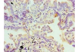 Immunohistochemistry (IHC) image for anti-Farnesyl-Diphosphate Farnesyltransferase 1 (FDFT1) (AA 1-260) antibody (ABIN7170658)