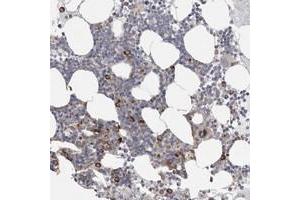 Immunohistochemical staining of human bone marrow with FBXO43 polyclonal antibody  shows strong cytoplasmic positivity in subsets of bone marrow poietic cells. (FBXO43 Antikörper)