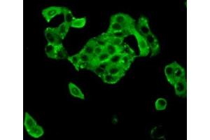 Detection of TTK in MCF7 cells using Polyclonal Antibody to TTK Protein Kinase (TTK) (Mps1 Antikörper  (AA 532-786))