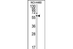 Western blot analysis of anti-P17 Antibody (Center) (ABIN390141 and ABIN2840645) in NCI- cell line lysates (35 μg/lane). (MMP17 Antikörper  (AA 391-420))