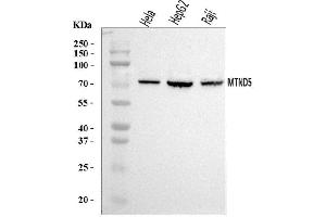Western blot analysis of MT-ND5 using anti-MT-ND5 antibody (ABIN7600145). (MT-ND5 Antikörper  (AA 154-570))