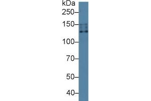 Detection of NCCT in Human 293T cell lysate using Polyclonal Antibody to Na-Cl Cotransporter (NCCT) (SLC12A3 Antikörper  (AA 3-146))