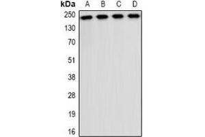 Western blot analysis of CD35 expression in A549 (A), NIH3T3 (B), mouse liver (C), mouse brain (D) whole cell lysates. (CD35 Antikörper)