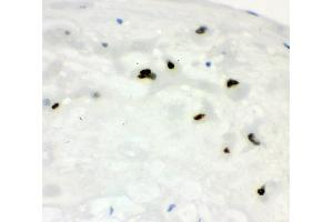 IHC analysis of CCNE1 using anti-CCNE1 antibody (ABIN7601193). (Cyclin E1 Antikörper  (AA 3-386))