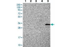 Western blot analysis of Lane 1: RT-4, Lane 2: U-251 MG, Lane 3: Human Plasma, Lane 4: Liver, Lane 5: Tonsil with FAM70B polyclonal antibody . (TMEM255B Antikörper)