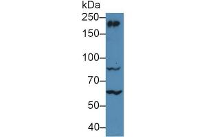 Western Blot; Sample: Mouse Cerebrum lysate; Primary Ab: 5µg/ml Rabbit Anti-Human MYH10 Antibody Second Ab: 0. (MYH10 Antikörper  (AA 438-716))