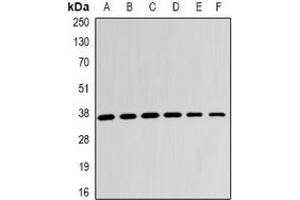 Western blot analysis of LDHB expression in A431 (A), Jurkat (B), A549 (C), mouse kidney (D), mouse lung (E), rat brain (F) whole cell lysates. (LDHB Antikörper)