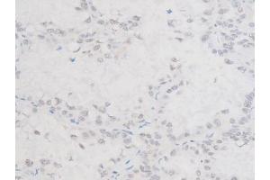 Immunohistochemistry (IHC) image for anti-LIM Domain Kinase 1 (LIMK1) (pThr508) antibody (ABIN6255701)