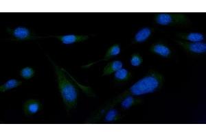 IF analysis of PLCG 2/PLCG2 using anti-PLCG 2/PLCG2 antibody (ABIN5692854). (Phospholipase C gamma 2 Antikörper  (AA 1201-1258))
