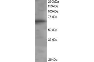 Western Blotting (WB) image for anti-Docking Protein 3 (DOK3) (C-Term) antibody (ABIN2465609) (DOK3 Antikörper  (C-Term))