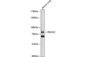 Western blot analysis of extracts of mouse lung, using FBXO42 antibody (ABIN7267092) at 1:1000 dilution. (FBXO42 Antikörper  (AA 468-717))