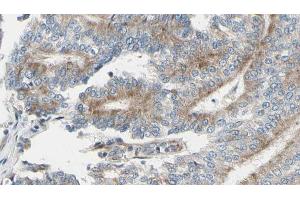 ABIN6268879 at 1/100 staining Human prostate tissue by IHC-P. (Actin Antikörper  (N-Term))
