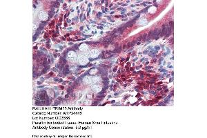 Immunohistochemistry with Human Small Intestine tissue at an antibody concentration of 5. (TRIM35 Antikörper  (Middle Region))
