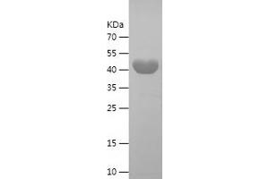 STING/TMEM173 Protein (AA 147-357) (His-IF2DI Tag)