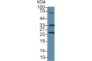Western Blot; Sample: Rat Serum; Primary Ab: 3µg/ml Rabbit Anti-Rat GSTp Antibody Second Ab: 0.