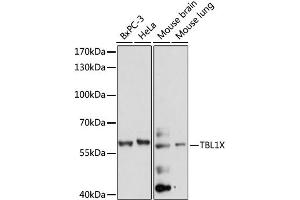 Western blot analysis of extracts of various cell lines, using TBL1X antibody. (TBL1X Antikörper)