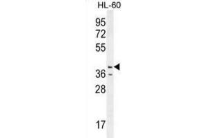 Western Blotting (WB) image for anti-Caspase 12 (Gene/pseudogene) (CASP12) antibody (ABIN2996496)