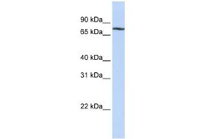 WB Suggested Anti-MYBL1 Antibody Titration:  0. (MYBL1 Antikörper  (C-Term))